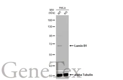 Anti-Lamin B1 antibody used in Western Blot (WB). GTX103292