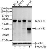 Anti-Lamin B1 antibody used in Western Blot (WB). GTX54288