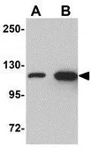 Anti-beta Galactosidase antibody used in Western Blot (WB). GTX85284